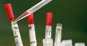 Medikamenti shëron majmunët nga Ebola, shpresë për efekt edhe te njerëzit