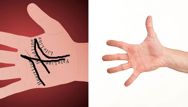 Ke shenjën X në pëllëmbën e dorës?! Ja çfarë do të thotë