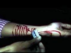 Durrës, 24 vjeçarja pret damarët, babai denoncon dy misionaret e kishës