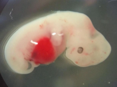 Një shpresë e re për krizën e transplantit të organeve, shkencëtarët krijojnë hibridin njeri-derr