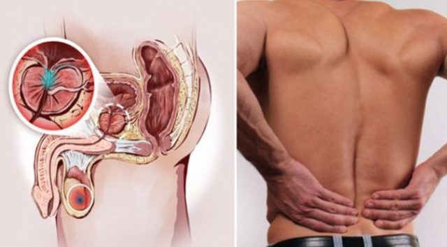 MEN-Do-YOU-Have-Prostate-Cancer.-12-Early-Symptoms-YOU-Should-Never-Ignore-and-Natural-Ways-to-Prevent-It-From-Happening