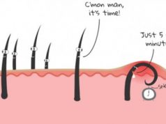 Si të stimuloni daljen e qimeve që rriten nën lëkurë