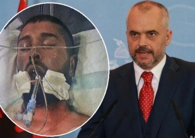 edi-rama floren beqiri