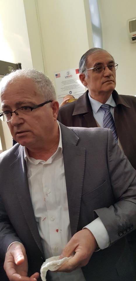 Edmond Spaho, sdhunuar nga policia1