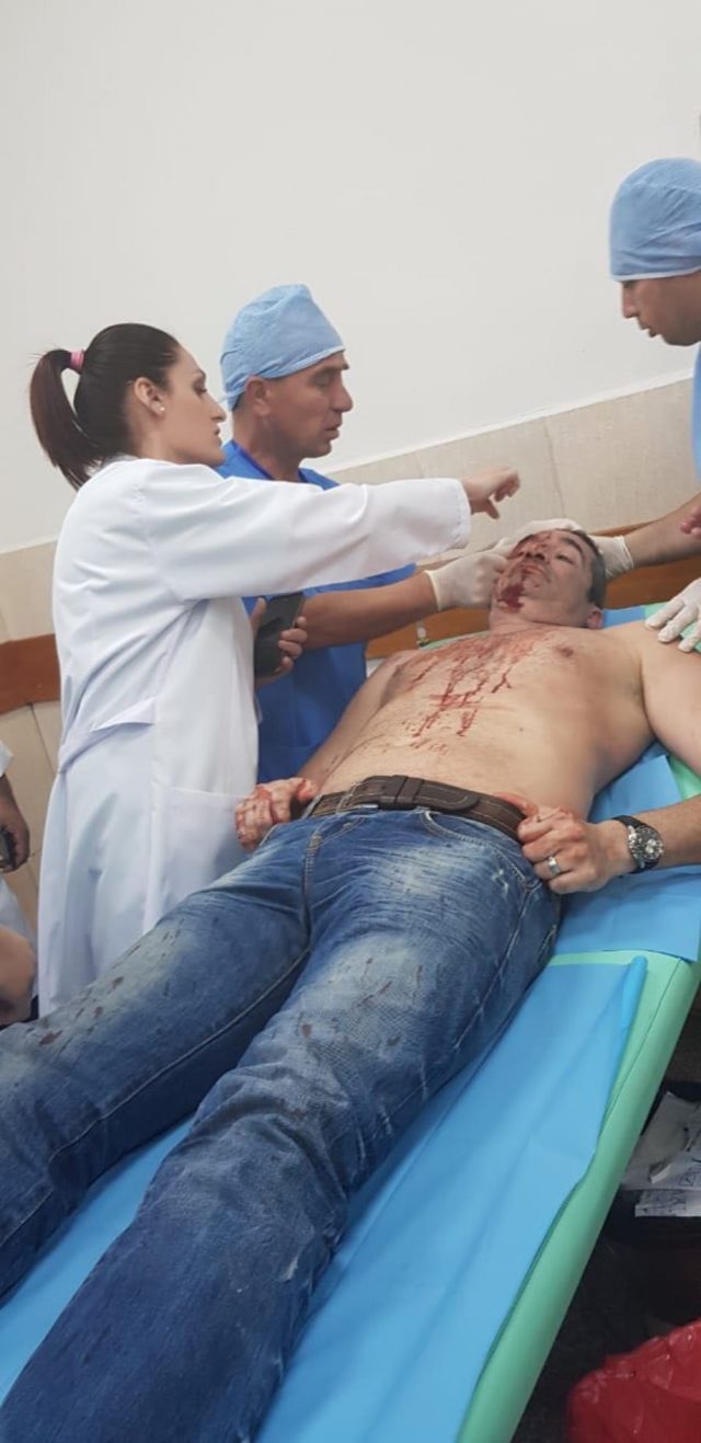 Bledi Kasmi, gjakosur5